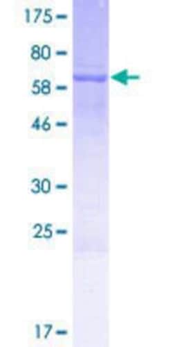 Novus Biologicals Recombinant Human C3P1 GST (N-Term) Protein 25 &mu;g | Buy Online | Novus Biologicals&trade; | Fisher Scientific