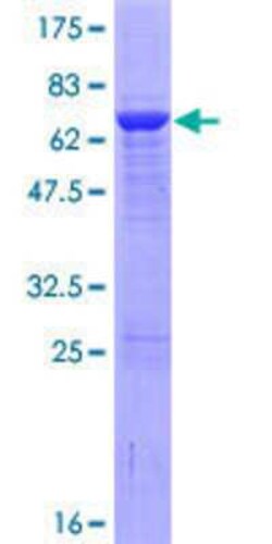 Novus Biologicals&trade;&nbsp;Recombinant Human RPSAP58 GST (N-Term) Protein