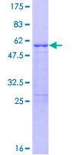 Novus Biologicals&trade;&nbsp;Recombinant Human RNF207 GST (N-Term) Protein