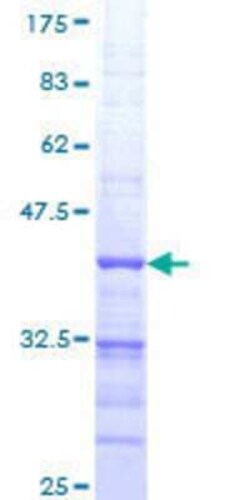 Novus Biologicals Recombinant Human RNF207 GST (N-Term) Protein 10 &mu;g | Buy Online | Novus Biologicals&trade; | Fisher Scientific