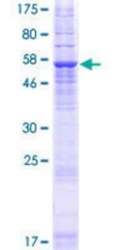 Novus Biologicals Recombinant Human TMEM82 GST (N-Term) Protein 10 &mu;g | Buy Online | Novus Biologicals&trade; | Fisher Scientific