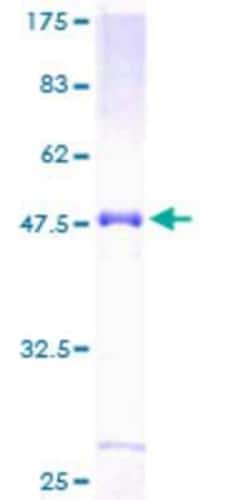 Novus Biologicals Recombinant Human NT2NL GST (N-Term) Protein 25 &mu;g | Buy Online | Novus Biologicals&trade; | Fisher Scientific