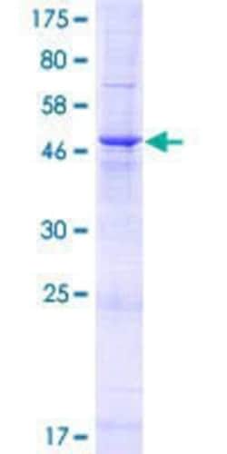 Novus Biologicals Recombinant Human TMEM81 GST (N-Term) Protein 25 &mu;g | Buy Online | Novus Biologicals&trade; | Fisher Scientific