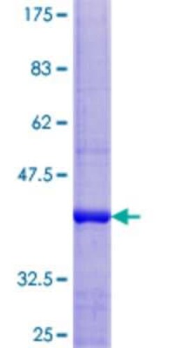Novus Biologicals&trade;&nbsp;Recombinant Human COA6 GST (N-Term) Protein