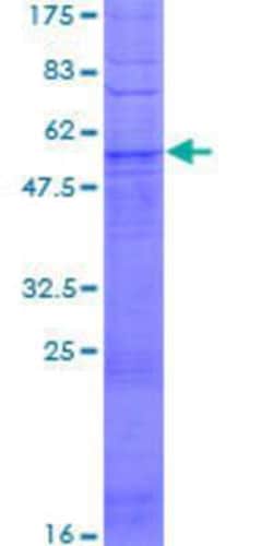 Novus Biologicals Recombinant Human OR51I2 GST (N-Term) Protein 10 &mu;g | Buy Online | Novus Biologicals&trade; | Fisher Scientific