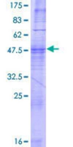 Novus Biologicals Recombinant Human OR52E4 GST (N-Term) Protein 2 &mu;g | Buy Online | Novus Biologicals&trade; | Fisher Scientific