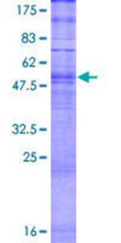 Novus Biologicals Recombinant Human OR5D16 GST (N-Term) Protein 2 &mu;g | Buy Online | Novus Biologicals&trade; | Fisher Scientific
