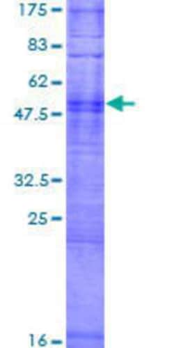 Novus Biologicals Recombinant Human OR8H2 GST (N-Term) Protein 2 &mu;g | Buy Online | Novus Biologicals&trade; | Fisher Scientific