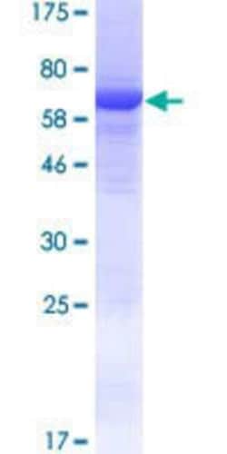Novus Biologicals&trade;&nbsp;Recombinant Human GDPGP1 GST (N-Term) Protein