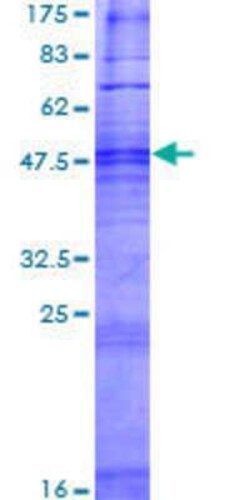 Novus Biologicals Recombinant Human OR4F15 GST (N-Term) Protein 2 &mu;g | Buy Online | Novus Biologicals&trade; | Fisher Scientific