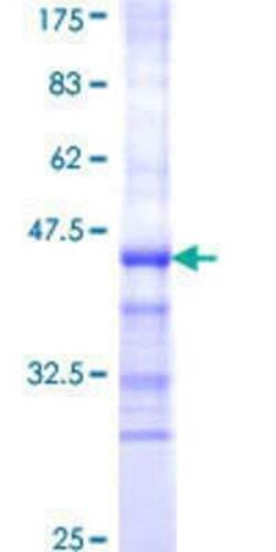 Novus Biologicals Recombinant Human LOC399491 GPS, PLAT and transmembrane domain-containing protein GST (N-Term) Protein 10 &mu;g | Buy Online | Novus Biologicals&trade; | Fisher Scientific