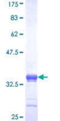 Novus Biologicals Recombinant Human MEX3D GST (N-Term) Protein 25 &mu;g | Buy Online | Novus Biologicals&trade; | Fisher Scientific