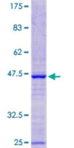 Novus Biologicals Recombinant Human RPL13AP17 GST (N-Term) Protein 10 &mu;g | Buy Online | Novus Biologicals&trade; | Fisher Scientific