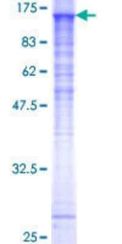 Novus Biologicals Recombinant Human SNX19 GST (N-Term) Protein 25 &mu;g | Buy Online | Novus Biologicals&trade; | Fisher Scientific