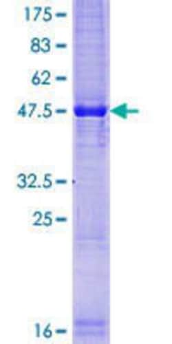 Novus Biologicals Recombinant Human TEX19 GST (N-Term) Protein 10 &mu;g | Buy Online | Novus Biologicals&trade; | Fisher Scientific
