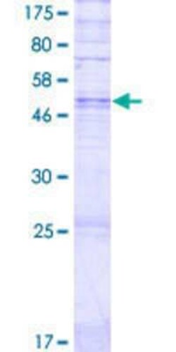 Novus Biologicals Recombinant Human OR14I1 GST (N-Term) Protein 2 &mu;g | Buy Online | Novus Biologicals&trade; | Fisher Scientific