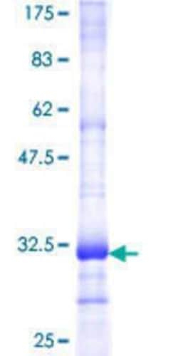 Novus Biologicals Recombinant Human OR2A42 GST (N-Term) Protein 10 &mu;g | Buy Online | Novus Biologicals&trade; | Fisher Scientific