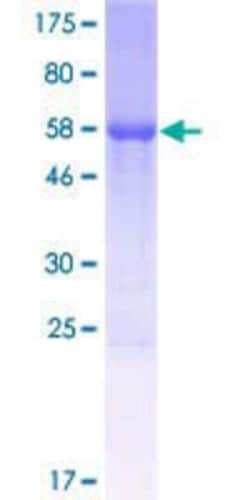 Novus Biologicals&trade;&nbsp;Recombinant Human hCG_2023776 heterogeneous nuclear ribonucleoprotein A1 pseudogene GST (N-Term) Protein