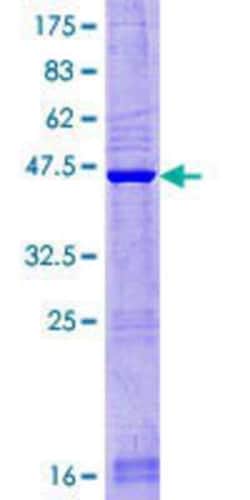 Novus Biologicals Recombinant Human MGC70870 GST (N-Term) Protein 25 &mu;g | Buy Online | Novus Biologicals&trade; | Fisher Scientific