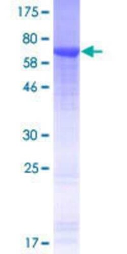 Novus Biologicals Recombinant Human LOC407835 mitogen-activated protein kinase kinase 2 pseudogene GST (N-Term) Protein 25 &mu;g | Buy Online | Novus Biologicals&trade; | Fisher Scientific
