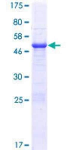 Novus Biologicals Recombinant Human C2orf27B GST (N-Term) Protein 10 &mu;g | Buy Online | Novus Biologicals&trade; | Fisher Scientific
