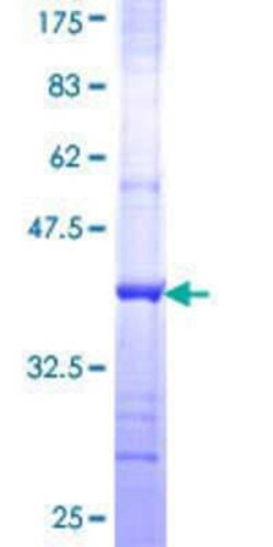 Novus Biologicals Recombinant Human GCN2 GST (N-Term) Protein 10 &mu;g | Buy Online | Novus Biologicals&trade; | Fisher Scientific