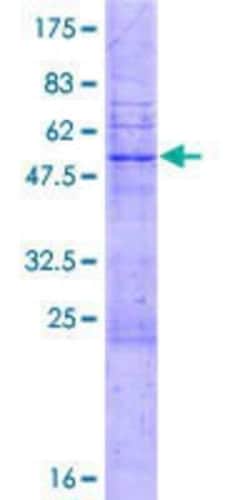 Novus Biologicals&trade;&nbsp;Recombinant Human PLEKHM1P GST (N-Term) Protein