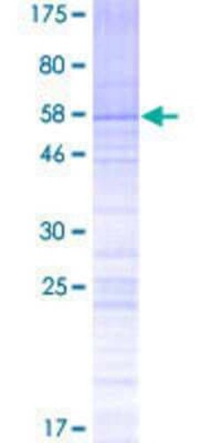 Novus Biologicals Recombinant Human SPDYE2 GST (N-Term) Protein 2 &mu;g | Buy Online | Novus Biologicals&trade; | Fisher Scientific