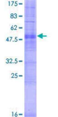 Novus Biologicals Recombinant Human OR9K2 GST (N-Term) Protein 2 &mu;g | Buy Online | Novus Biologicals&trade; | Fisher Scientific