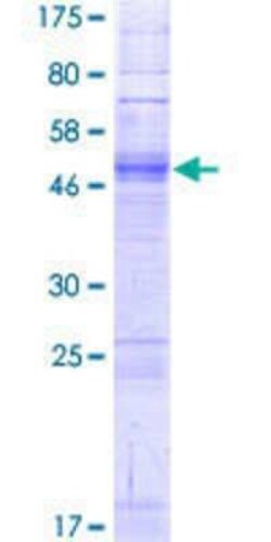 Novus Biologicals Recombinant Human OR2J1 GST (N-Term) Protein 10 &mu;g | Buy Online | Novus Biologicals&trade; | Fisher Scientific