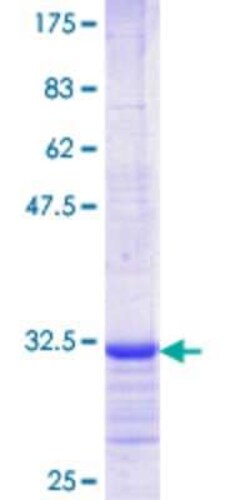 Novus Biologicals Recombinant Human OR2A2 GST (N-Term) Protein 10 &mu;g | Buy Online | Novus Biologicals&trade; | Fisher Scientific