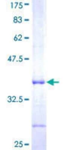 Novus Biologicals Recombinant Human TRIM6-TRIM34 GST (N-Term) Protein 10 &mu;g | Buy Online | Novus Biologicals&trade; | Fisher Scientific