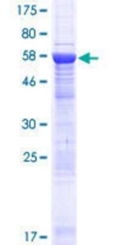 Novus Biologicals Recombinant Human EID3 GST (N-Term) Protein 10 &mu;g | Buy Online | Novus Biologicals&trade; | Fisher Scientific