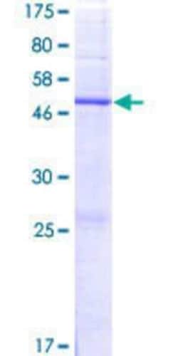 Novus Biologicals Recombinant Human GPX8 GST (N-Term) Protein 2 &mu;g | Buy Online | Novus Biologicals&trade; | Fisher Scientific