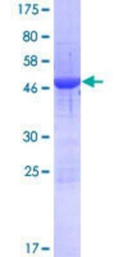 R&D Systems&trade;&nbsp;Recombinant Human PHBP19 GST (N-Term) Protein