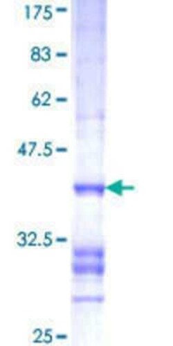 Novus Biologicals Recombinant Human FBXO47 GST (N-Term) Protein 10 &mu;g | Buy Online | Novus Biologicals&trade; | Fisher Scientific