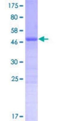 Novus Biologicals&trade;&nbsp;Recombinant Human CT45A1 GST (N-Term) Protein
