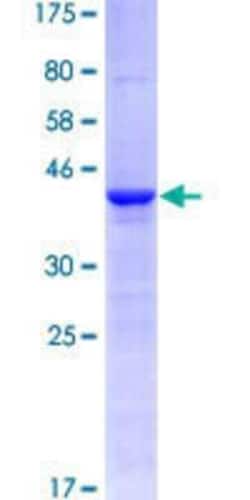 Novus Biologicals Recombinant Human CLLU1OS GST (N-Term) Protein 10 &mu;g | Buy Online | Novus Biologicals&trade; | Fisher Scientific