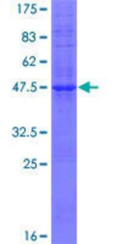 Novus Biologicals&trade;&nbsp;Recombinant Human RPS14P3 GST (N-Term) Protein