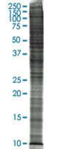 Novus Biologicals&trade;&nbsp;SW-13 Nuclear Cell Lysate