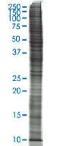 Novus Biologicals&trade;&nbsp;SW-13 Nuclear Cell Lysate