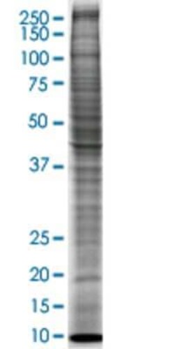 Novus Biologicals&trade;&nbsp;U-2 OS Nuclear Cell Lysate