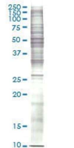Novus Biologicals&trade;&nbsp;SJCRH30 Nuclear Cell Lysate