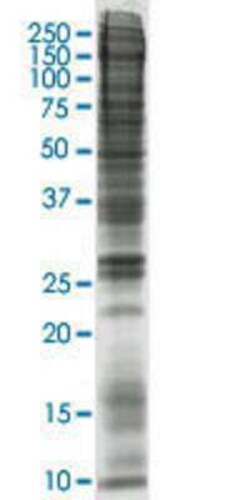 Novus Biologicals&trade;&nbsp;Y-79 Nuclear Cell Lysate
