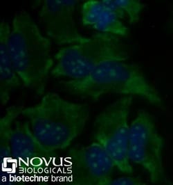 rRNA Antibody (Y10b) - BSA Free, Novus Biologicals 0.025mL; Unlabeled:Antibodies,