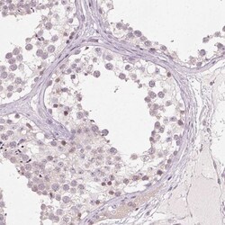 sFRP-4 Antibody, Novus Biologicals 0.1mL; Unlabeled:Antibodies, Polyclonal