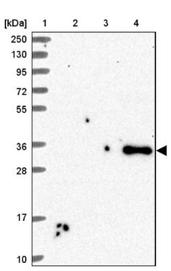 sFRP-4 Antibody, Novus Biologicals 0.1mL; Unlabeled:Antibodies, Polyclonal