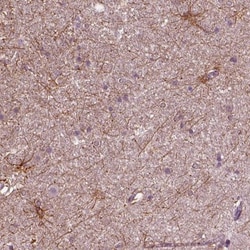 shootin-1 Antibody, Novus Biologicals 0.1mL; Unlabeled:Antibodies, Polyclonal