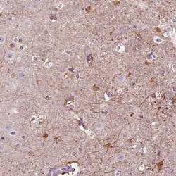 shootin-1 Antibody, Novus Biologicals 0.1mL; Unlabeled:Antibodies, Polyclonal