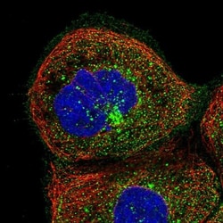 smu1 Antibody, Novus Biologicals 25 &mu;L | Buy Online | Novus Biologicals | Fisher Scientific